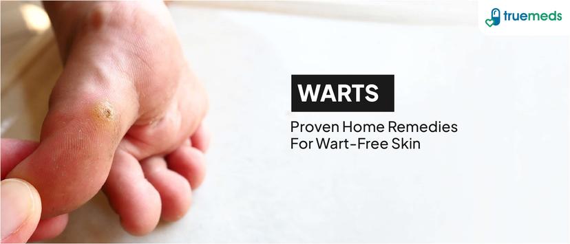 16 Natural Home Remedies for Warts