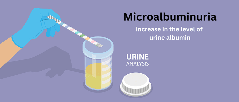 Understanding Microalbuminuria: Causes, Symptoms, and Treatment Options